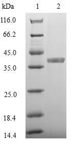 (Tris-Glycine gel) Discontinuous SDS-PAGE (reduced) with 5% enrichment gel and 15% separation gel.